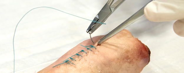 Im Nahtkurs üben die Studierenden verschiedene Techniken – auch an Schweinefüßen. (Foto: Peter Pulkowski) Im Nahtkurs üben die Studierenden verschiedene Techniken – auch an Schweinefüßen. (Foto: Peter Pulkowski)