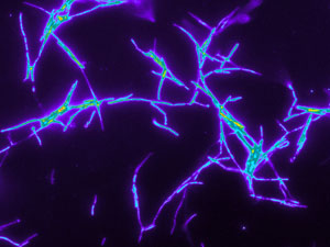 Fluorescence in-situ hybridization of the bacteria after secretion into brood cell, © Martin Kaltenpoth